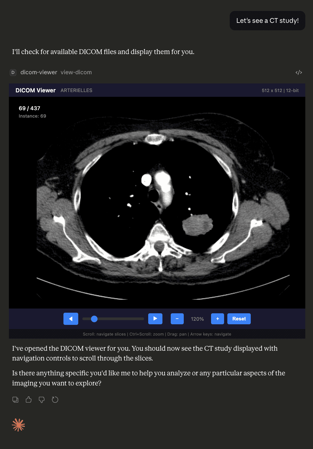DICOM viewer showing a medical image series with slice navigation controls in Claude Desktop